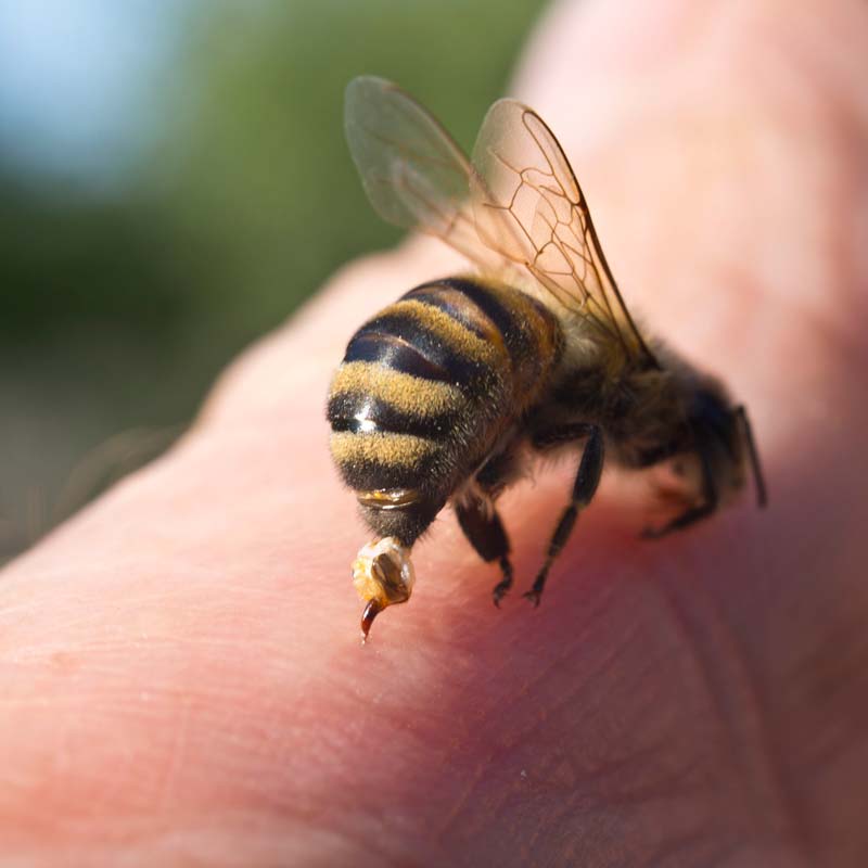 cosa fare se si viene punti da un calabrone